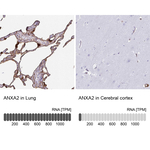 Annexin A2 Antibody in Immunohistochemistry (Paraffin) (IHC (P))