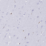 Annexin A2 Antibody in Immunohistochemistry (Paraffin) (IHC (P))