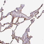Annexin A2 Antibody in Immunohistochemistry (Paraffin) (IHC (P))