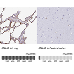 Annexin A2 Antibody in Immunohistochemistry (Paraffin) (IHC (P))