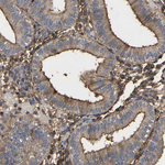 LIF Antibody in Immunohistochemistry (Paraffin) (IHC (P))