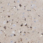 LIF Antibody in Immunohistochemistry (Paraffin) (IHC (P))
