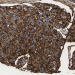 LIF Antibody in Immunohistochemistry (Paraffin) (IHC (P))