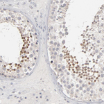 STAT4 Antibody in Immunohistochemistry (Paraffin) (IHC (P))