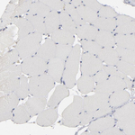 STAT4 Antibody in Immunohistochemistry (Paraffin) (IHC (P))