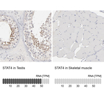 STAT4 Antibody in Immunohistochemistry (Paraffin) (IHC (P))