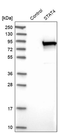 STAT4 Antibody in Western Blot (WB)