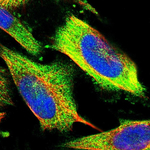 PKC zeta Polyclonal Antibody