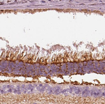 PKC zeta Antibody in Immunohistochemistry (Paraffin) (IHC (P))