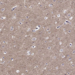 PKC zeta Antibody in Immunohistochemistry (Paraffin) (IHC (P))
