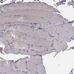 PKC zeta Antibody in Immunohistochemistry (Paraffin) (IHC (P))