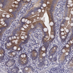 PKC zeta Antibody in Immunohistochemistry (Paraffin) (IHC (P))