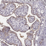 PKC zeta Antibody in Immunohistochemistry (Paraffin) (IHC (P))