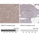 PKC zeta Antibody in Immunohistochemistry (Paraffin) (IHC (P))