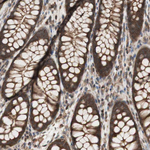 14-3-3 beta Antibody in Immunohistochemistry (Paraffin) (IHC (P))