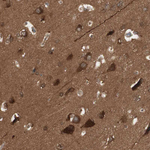 14-3-3 beta Antibody in Immunohistochemistry (Paraffin) (IHC (P))