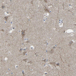 BCL-10 Antibody in Immunohistochemistry (Paraffin) (IHC (P))