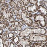 BCL-10 Antibody in Immunohistochemistry (Paraffin) (IHC (P))