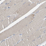 BCL-10 Antibody in Immunohistochemistry (Paraffin) (IHC (P))
