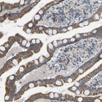 BCL-10 Antibody in Immunohistochemistry (Paraffin) (IHC (P))
