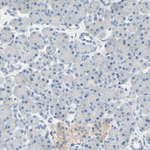 MUNC18 Antibody in Immunohistochemistry (Paraffin) (IHC (P))