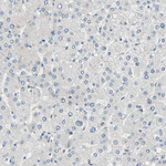 MUNC18 Antibody in Immunohistochemistry (Paraffin) (IHC (P))