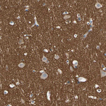 MUNC18 Antibody in Immunohistochemistry (Paraffin) (IHC (P))