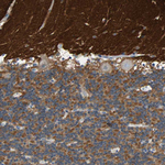 MUNC18 Antibody in Immunohistochemistry (Paraffin) (IHC (P))
