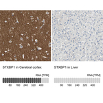 MUNC18 Antibody in Immunohistochemistry (Paraffin) (IHC (P))