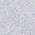 MUNC18 Antibody in Immunohistochemistry (Paraffin) (IHC (P))