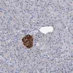 MUNC18 Antibody in Immunohistochemistry (Paraffin) (IHC (P))