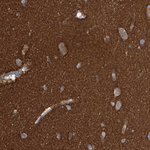 MUNC18 Antibody in Immunohistochemistry (Paraffin) (IHC (P))