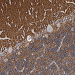 MUNC18 Antibody in Immunohistochemistry (Paraffin) (IHC (P))
