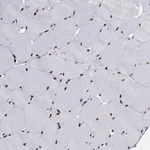 APE1 Antibody in Immunohistochemistry (Paraffin) (IHC (P))