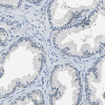 Occludin Antibody in Immunohistochemistry (Paraffin) (IHC (P))