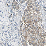 Occludin Antibody in Immunohistochemistry (Paraffin) (IHC (P))