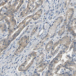Occludin Polyclonal Antibody