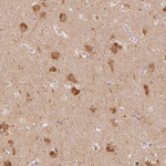 LC3A Antibody in Immunohistochemistry (Paraffin) (IHC (P))