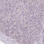LC3A Antibody in Immunohistochemistry (Paraffin) (IHC (P))