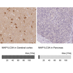 LC3A Antibody in Immunohistochemistry (Paraffin) (IHC (P))