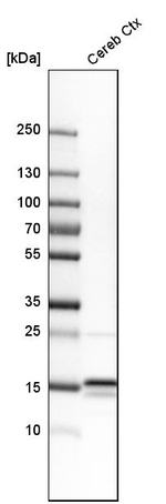 LC3A Antibody in Western Blot (WB)
