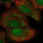 MEK6 Polyclonal Antibody