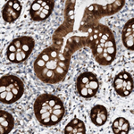 MEK6 Antibody in Immunohistochemistry (Paraffin) (IHC (P))