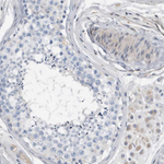 MEK6 Antibody in Immunohistochemistry (Paraffin) (IHC (P))