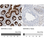 MEK6 Antibody in Immunohistochemistry (Paraffin) (IHC (P))