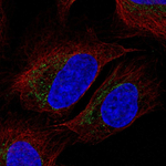TFAM Polyclonal Antibody