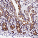 TFAM Antibody in Immunohistochemistry (Paraffin) (IHC (P))