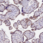 TFAM Antibody in Immunohistochemistry (Paraffin) (IHC (P))