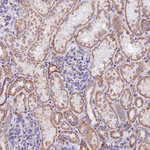 TFAM Antibody in Immunohistochemistry (Paraffin) (IHC (P))