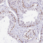 TFAM Antibody in Immunohistochemistry (Paraffin) (IHC (P))